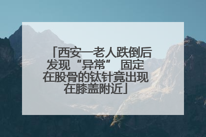西安一老人跌倒后发现“异常” 固定在股骨的钛针竟出现在膝盖附近